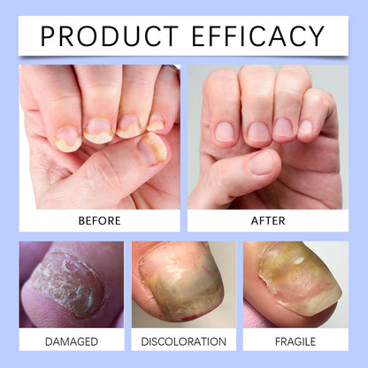 Nail care strips: gentle nail care, convenient for daily cleaning and easy to use.