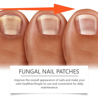 Nail care strips: gentle nail care, convenient for daily cleaning and easy to use.